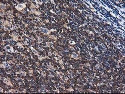 Invitrogen ADSL Monoclonal Antibody (OTI2D10) 100 μL; Unconjugated:Antibodies,