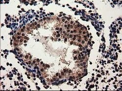 Invitrogen ADSL Monoclonal Antibody (OTI2D10) 100 μL; Unconjugated:Antibodies,