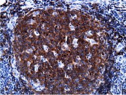 PIK3AP1 Monoclonal Antibody (OTI7A11):Antibodies, Monoclonal