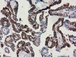Invitrogen Adenylate Kinase 3 Monoclonal Antibody (OTI5A1) 100 &mu;L; Unconjugated:Antibodies,