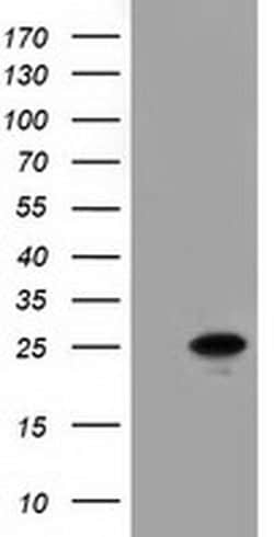 Invitrogen Adenylate Kinase 3 Monoclonal Antibody (OTI5A1) 100 &mu;L; Unconjugated:Antibodies,