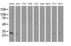 Invitrogen Adenylate Kinase 3 Monoclonal Antibody (OTI5A1) 100 &mu;L; Unconjugated:Antibodies,