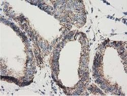 Invitrogen Adenylate Kinase 3 Monoclonal Antibody (OTI3G1) 100 &mu;L; Unconjugated:Antibodies,