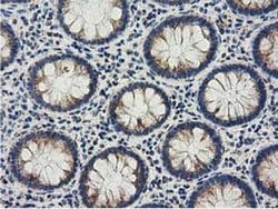 Invitrogen Adenylate Kinase 3 Monoclonal Antibody (OTI3G1) 100 &mu;L; Unconjugated:Antibodies,