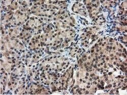 Invitrogen RNH1 Monoclonal Antibody (OTI3F11) 100 &mu;L | Buy Online | Invitrogen&trade; | Fisher Scientific