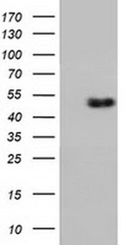 Invitrogen RNH1 Monoclonal Antibody (OTI3F11) 100 &mu;L | Buy Online | Invitrogen&trade; | Fisher Scientific