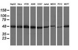 Invitrogen RNH1 Monoclonal Antibody (OTI3F11) 100 &mu;L | Buy Online | Invitrogen&trade; | Fisher Scientific