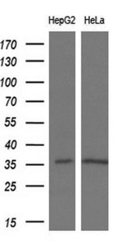 Invitrogen PYCR2 Monoclonal Antibody (OTI4A10) 100 &mu;L | Buy Online | Invitrogen&trade; | Fisher Scientific