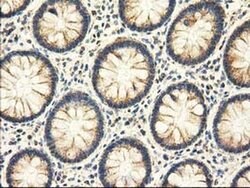 Invitrogen Adenylate Kinase 3 Monoclonal Antibody (OTI4C4) 100 &mu;L; Unconjugated:Antibodies,