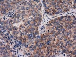 Invitrogen PYCR2 Monoclonal Antibody (OTI2A12) 100 &mu;L; Unconjugated:Antibodies,