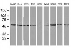 Invitrogen GSS Monoclonal Antibody (OTI2G3) 100 &mu;L; Unconjugated:Antibodies,