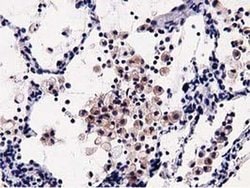Invitrogen OSBPL11 Monoclonal Antibody (OTI5A10) 100 &mu;L; Unconjugated:Antibodies,