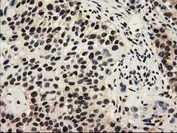 Invitrogen SULT1A1 Monoclonal Antibody (OTI9B7) 100 &mu;L; Unconjugated:Antibodies,