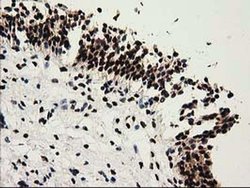 Invitrogen SULT1A1 Monoclonal Antibody (OTI9B7) 100 &mu;L; Unconjugated:Antibodies,