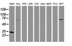 Invitrogen SULT1A1 Monoclonal Antibody (OTI9B7) 100 &mu;L; Unconjugated:Antibodies,