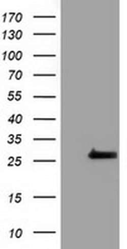 Invitrogen OTUB2 Monoclonal Antibody (OTI6C7) 100 &mu;L; Unconjugated:Antibodies,