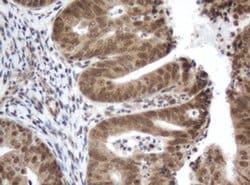 Invitrogen ZIM2 Monoclonal Antibody (OTI6D12) 100 &mu;L; Unconjugated:Antibodies,