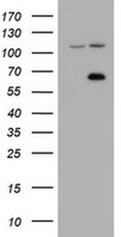 Invitrogen ZIM2 Monoclonal Antibody (OTI6D12) 100 &mu;L; Unconjugated:Antibodies,
