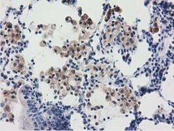 Invitrogen RASD2 Monoclonal Antibody (OTI1G1) 100 &mu;L; Unconjugated:Antibodies,