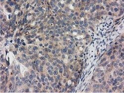 Invitrogen RASD2 Monoclonal Antibody (OTI1G1) 100 &mu;L; Unconjugated:Antibodies,