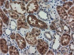 Invitrogen RASD2 Monoclonal Antibody (OTI1G1) 100 &mu;L; Unconjugated:Antibodies,