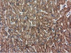 Invitrogen RASD2 Monoclonal Antibody (OTI1G1) 100 &mu;L; Unconjugated:Antibodies,