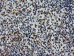 Invitrogen SAMHD1 Monoclonal Antibody (OTI3F5) 100 &mu;L | Buy Online | Invitrogen&trade; | Fisher Scientific