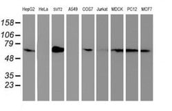 Invitrogen SAMHD1 Monoclonal Antibody (OTI3F5) 100 &mu;L | Buy Online | Invitrogen&trade; | Fisher Scientific
