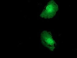 Invitrogen FKBPL Monoclonal Antibody (OTI4G1) 100 &mu;L; Unconjugated:Antibodies,