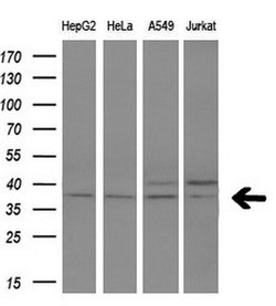 Invitrogen FKBPL Monoclonal Antibody (OTI4G1) 100 &mu;L; Unconjugated:Antibodies,