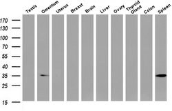Invitrogen Annexin A3 Monoclonal Antibody (OTI1F11) 100 &mu;L | Buy Online | Invitrogen&trade; | Fisher Scientific