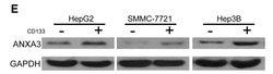 Invitrogen Annexin A3 Monoclonal Antibody (OTI1F11) 100 &mu;L | Buy Online | Invitrogen&trade; | Fisher Scientific