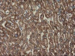 Invitrogen CLPP Monoclonal Antibody (OTI1G9) 100 &mu;L; Unconjugated:Antibodies,