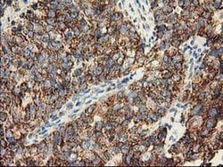 Invitrogen CLPP Monoclonal Antibody (OTI1G9) 100 &mu;L; Unconjugated:Antibodies,