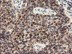 Invitrogen CLPP Monoclonal Antibody (OTI1G9) 100 &mu;L; Unconjugated:Antibodies,