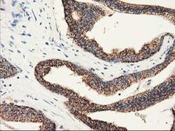 Invitrogen CLPP Monoclonal Antibody (OTI1G9) 100 &mu;L; Unconjugated:Antibodies,