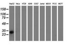 Invitrogen RASD2 Monoclonal Antibody (OTI1D11) 100 &mu;L; Unconjugated:Antibodies,