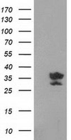 Invitrogen GRHPR Monoclonal Antibody (OTI1A9) 100 &mu;L; Unconjugated:Antibodies,