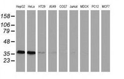 Invitrogen GRHPR Monoclonal Antibody (OTI1A9) 100 &mu;L; Unconjugated:Antibodies,