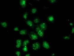 Invitrogen Annexin A3 Monoclonal Antibody (OTI2F3) 100 &mu;L; Unconjugated:Antibodies,