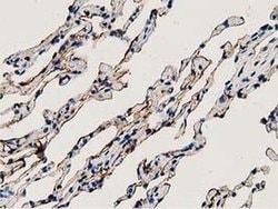 Invitrogen Annexin A3 Monoclonal Antibody (OTI2F3) 100 &mu;L; Unconjugated:Antibodies,