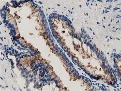 Invitrogen Annexin A3 Monoclonal Antibody (OTI2F3) 100 &mu;L; Unconjugated:Antibodies,