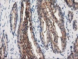 Invitrogen Annexin A3 Monoclonal Antibody (OTI1A5) 100 &mu;L; Unconjugated:Antibodies,