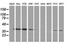 Invitrogen Annexin A3 Monoclonal Antibody (OTI1A5) 100 &mu;L; Unconjugated:Antibodies,