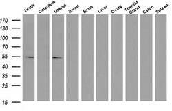 Invitrogen LMAN1 Monoclonal Antibody (OTI1A8) 100 &mu;L; Unconjugated:Antibodies,
