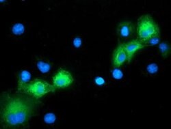 Invitrogen ERK5 Monoclonal Antibody (OTI3D4) 100 &mu;L; Unconjugated:Antibodies,