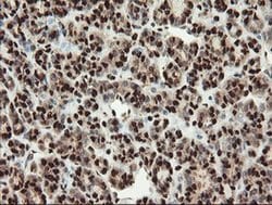 Invitrogen SAMHD1 Monoclonal Antibody (OTI1A1) 100 &mu;L; Unconjugated:Antibodies,