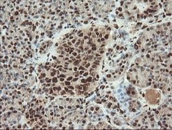 Invitrogen SAMHD1 Monoclonal Antibody (OTI1A1) 100 &mu;L; Unconjugated:Antibodies,