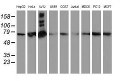 Invitrogen SAMHD1 Monoclonal Antibody (OTI1A1) 100 &mu;L; Unconjugated:Antibodies,