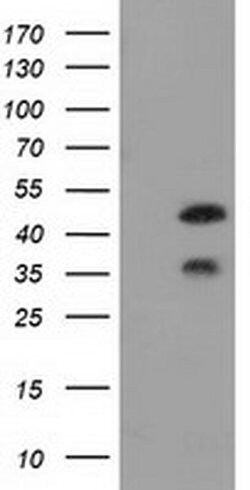 Invitrogen FKBPL Monoclonal Antibody (OTI2D8) 100 &mu;L | Buy Online | Invitrogen&trade; | Fisher Scientific